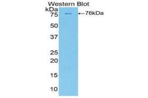Western Blotting (WB) image for anti-Phospholipase A2-Activating Protein (PLAA) (AA 534-792) antibody (ABIN1860255)