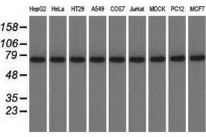 Western blot analysis of extracts (35 µg) from 9 different cell lines by using anti-KBTBD7 monoclonal antibody. (KBTBD7 antibody)