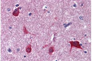 Human Brain, cortex: Formalin-Fixed, Paraffin-Embedded (FFPE) (EEF1A2 antibody  (AA 238-443))
