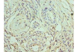 Immunohistochemistry of paraffin-embedded human epityphlon tissue using ABIN7169786 at dilution of 1:100 (SLAMF7 antibody  (AA 23-226))