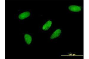 Immunofluorescence of monoclonal antibody to TCEA3 on HeLa cell. (TCEA3 antibody  (AA 1-348))
