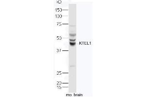 Mouse brain lysates probed with Rabbit Anti-KTELC1 Polyclonal Antibody, Unconjugated  at 1:5000 for 90min at 37˚C.
