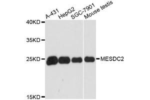 Western blot analysis of extracts of various cell lines, using MESDC2 antibody. (MESDC2 antibody)