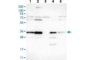 Western blot analysis of Lane 1: RT-4, Lane 2: U-251 MG, Lane 3: Human Plasma, Lane 4: Liver, Lane 5: Tonsil with LRRC59 polyclonal antibody  at 1:250-1:500 dilution. (LRRC59 antibody)