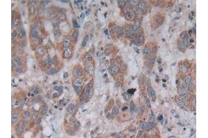 Immunohistochemistry (IHC) image for anti-5'-Nucleotidase, Cytosolic III (NT5C3) (AA 52-336) antibody (ABIN7442483)