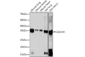 Western blot analysis of extracts of various cell lines, using Calponin Rabbit mAb (ABIN1678670, ABIN3018018, ABIN3018019 and ABIN7101568) at 1:1000 dilution. (CNN1 antibody)