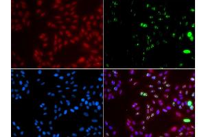 Immunofluorescence analysis of GFP-RNF168 transgenic U2OS cell using XPA antibody. (XPA antibody)