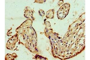 Immunohistochemistry of paraffin-embedded human placenta tissue using ABIN7143011 at dilution of 1:100 (PHAP1 antibody  (AA 1-170))