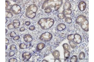 Immunoperoxidase of monoclonal antibody to OXSR1 on formalin-fixed paraffin-embedded human small Intestine. (OXSR1 antibody  (AA 1-527))