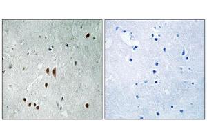 Immunohistochemistry analysis of paraffin-embedded human brain tissue using CNOT2 (Phospho-Ser101) antibody.