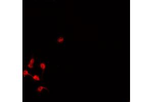 ABIN6276956 staining HepG2? (DLC1 antibody  (N-Term))