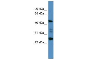 WB Suggested Anti-OSGIN2 Antibody Titration: 0. (OSGIN2 antibody  (C-Term))