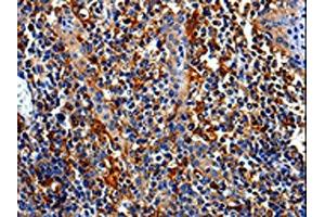 The image is immunohistochemistry of paraffin-embedded Human tonsil tissue using ABIN7129010(COX16 Antibody) at dilution 1/50. (COX16 antibody)
