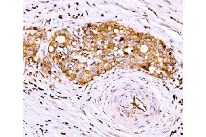 IHC analysis of AGPAT2 using anti-AGPAT2 antibody (ABIN7602435). (AGPAT2 antibody  (AA 77-178))