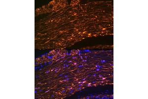 Immunofluorescence analysis of rat rectum using Calponin Rabbit mAb (ABIN1678670, ABIN3018018, ABIN3018019 and ABIN7101568) at dilution of 1:100 (40x lens). (CNN1 antibody)