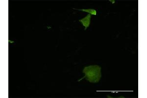 Immunofluorescence of monoclonal antibody to MPZL2 on HeLa cell. (MPZL2 antibody  (AA 27-136))
