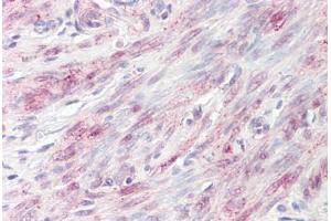 Image no. 2 for anti-BRISC and BRCA1 A Complex Member 1 (BABAM1) (AA 36-85) antibody (ABIN6749759) (BRISC and BRCA1 A Complex Member 1 (BABAM1) (AA 36-85) antibody)