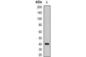 Western blot analysis of ABO expression in K562 (A) whole cell lysates. (ABO antibody)