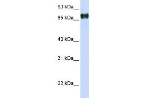 WB Suggested Anti-PLEKHA4 Antibody Titration:  0. (PLEKHA4 antibody  (N-Term))