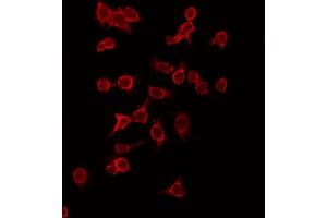 ABIN6269133 staining HepG2 by IF/ICC. (KIT antibody  (Internal Region))