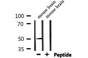 Western blot analysis of extracts from mouse brain, using NR1H3 Antibody. (NR1H3 antibody  (C-Term))