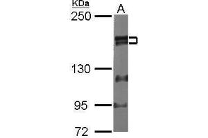 WB Image Sample (20 ug of whole cell lysate) A: human ESC 5% SDS PAGE antibody diluted at 1:1000 (ZMYM2 antibody  (Center))