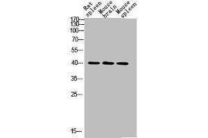 Western blot analysis of RAT-SPLEEN MOUSE-BRAIN MOUSE-SPLEEN lysis using CD72 antibody.
