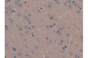 Detection of MAP6 in Mouse Brain Tissue using Polyclonal Antibody to Microtubule Associated Protein 6 (MAP6) (MAP6 antibody  (AA 177-387))