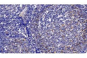 Immunohistochemistry (IHC) image for anti-Granzyme B (GZMB) (AA 21-247) antibody (ABIN7432145)