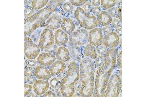 Immunohistochemistry of paraffin-embedded mouse kidney using AP2A1 Antibody.