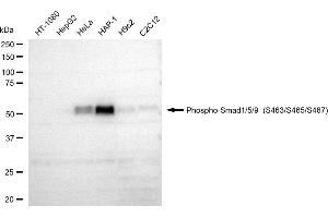 Western blotting analysis using Phospho-Smad1/5/9 (S463/S465/S467) antibody (ABIN7800369).