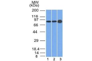 Western blot testing of human 1) U87, 2) HeLa and 3) A431 cell lysate with Plakophilin 1 antibody (clone 10B2).