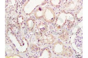 Formalin-fixed and paraffin embedded human kidney labeled with Anti-OCT1 Polyclonal Antibody, Unconjugated (ABIN737286) at 1:200 followed by conjugation to the secondary antibody and DAB staining (POU2F1 antibody  (C-Term))