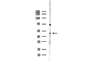 anti-Interleukin 11 Receptor, alpha (IL11RA) (C-Term) antibody