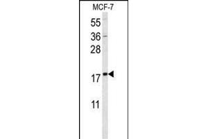 Western blot analysis of SUMO1 Antibody f in MCF-7 cell line lysates (35 μg/lane). (SUMO1 antibody)