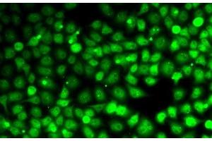 Immunofluorescence analysis of MCF7 cells using CCNE2 Polyclonal Antibody (Cyclin E2 antibody)