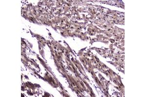IHC testing of FFPE rat heart tissue with NFIB antibody at 1ug/ml. (NFIB antibody)