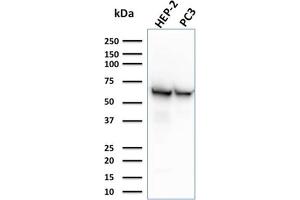 Western Blot Analysis of HEP-2 and PC3 cell lysates using HSP60 Mouse Monoclonal Antibody (CPTC-HSPD1-1).