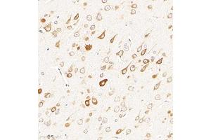 Immunohistochemistry of paraffin embedded rat brain using CHST6 (ABIN7073302) at dilution of 1:2000 (300x lens) (CHST6 antibody)