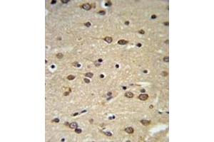 Immunohistochemistry (IHC) image for anti-delta-Like 2 Homolog (DLK2) antibody (ABIN3004005) (DLK2 antibody)