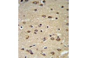 Immunohistochemistry (IHC) image for anti-delta-Like 2 Homolog (DLK2) antibody (ABIN5024466) (DLK2 antibody)