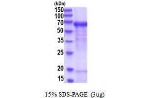 SDS-PAGE (SDS) image for Dopamine beta-Hydroxylase (Dopamine beta-Monooxygenase) (DBH) (AA 40-617) protein (His tag) (ABIN5854164)