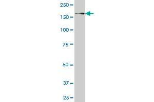 USP31 monoclonal antibody (M01), clone 3B6 Western Blot analysis of USP31 expression in A-431 . (USP31 antibody  (AA 1254-1352))