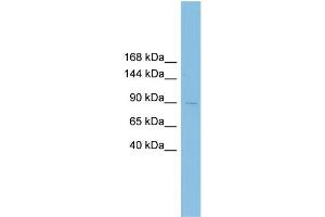WB Suggested Anti-XRRA1 Antibody Titration: 0. (XRRA1 antibody  (N-Term))