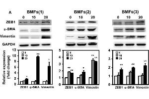 Western Blotting (WB) image for anti-Glyceraldehyde-3-Phosphate Dehydrogenase (GAPDH) antibody (ABIN2857072)