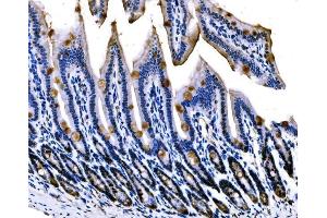 IHC analysis of Sigma1-Receptor/SIGMAR1 using anti-Sigma1-Receptor/SIGMAR1 antibody (ABIN7599011). (SIGMAR1 antibody  (AA 1-154))