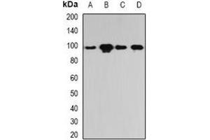 Western blot analysis of PYGL expression in Hela (A), SKOV3 (B), mouse lung (C), rat liver (D) whole cell lysates. (PYGL antibody)