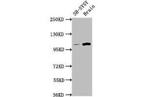 Western Blot Positive WB detected in: SH-SY5Y whole cell lysate, Rat brain tissue All lanes: LGR5 antibody at 1:1500 Secondary Goat polyclonal to rabbit IgG at 1/50000 dilution Predicted band size: 100, 98, 93 kDa Observed band size: 100 kDa (Recombinant LGR5 antibody)