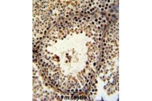 Immunohistochemistry (IHC) image for anti-PHD Finger Protein 13 (PHF13) antibody (ABIN3002222) (PHF13 antibody)