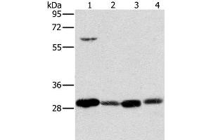 Western Blot analysis of 293T cell and Human testis tissue, A375 cell and Human normal kidney tissue using MRPL28 Polyclonal Antibody at dilution of 1:600 (MRPL28 antibody)